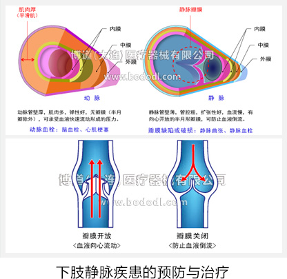 下肢静脉疾患的预防与治疗